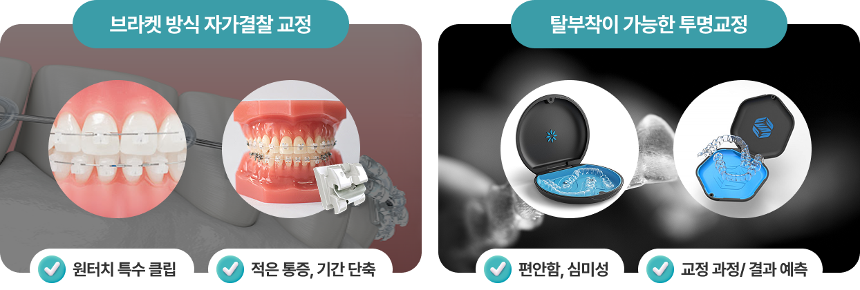 치아교정 장치